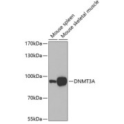 Western blot analysis of extracts of various cell lines using DNMT3A Antibody