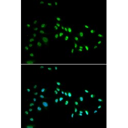 DNA Methyltransferase 3 Alpha (DNMT3A) Antibody