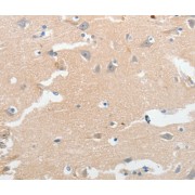 Immunohistochemistry of paraffin-embedded Human brain tissue using LCN2 Antibody (1/50 dilution)