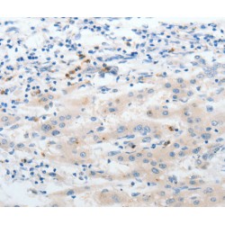 Neutrophil Gelatinase Associated Lipocalin / NGAL (LCN2) Antibody