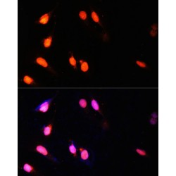 SET Domain Containing Protein 2 (SETD2) Antibody