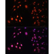 Immunofluorescence analysis of C6 cells using SETD2 Antibody (1/100 dilution, 40x lens). Blue: DAPI for nuclear staining.