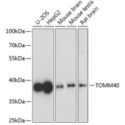 Western blot analysis of extracts of various cell lines using TOMM40 Antibody (1/1000 dilution).