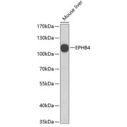 Western blot analysis of extracts of Mouse liver using EPHB4 Antibody (1/1000 dilution).