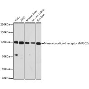 Western blot analysis of extracts of various cell lines using Mineralocorticoid receptor Antibody (1/1000 dilution).