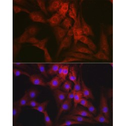 Mineralocorticoid Receptor (NR3C2) Antibody