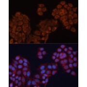 Immunofluorescence analysis of HeLa cells using ALDH6A1 Antibody (1/100 dilution). Blue: DAPI for nuclear staining.