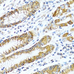 Leucine Rich PPR Motif Containing Protein (LRPPRC) Antibody