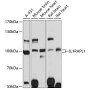 Western blot analysis of extracts of various cell lines using IL1RAPL1 Antibody (1/3000 dilution).