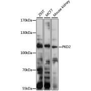 Western blot analysis of extracts of various cell lines using PKD2 Antibody (1/1000 dilution).