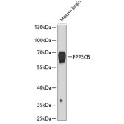 Western blot analysis of extracts of Mouse brain using PPP3CB Antibody (1/1000 dilution).