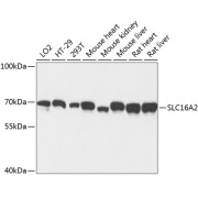 Western blot analysis of extracts of various cell lines using SLC16A2 Antibody (1/3000 dilution).