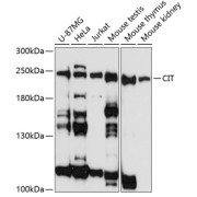 Western blot analysis of extracts of various cell lines using CIT Antibody (1/3000 dilution).