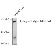 Western blot analysis of extracts of Mouse brain using Collagen III alpha 1/COL3A1 Antibody (1/1000 dilution).