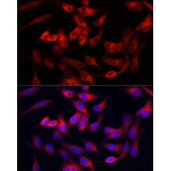 Collagen Type III Alpha 1 (COL3A1) Antibody