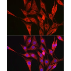 Collagen Type III Alpha 1 (COL3A1) Antibody