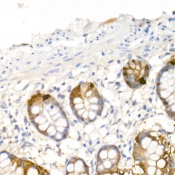 Aromatic-L-Amino-Acid Decarboxylase (DDC) Antibody