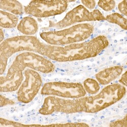 Aromatic-L-Amino-Acid Decarboxylase (DDC) Antibody