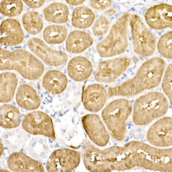 Aromatic-L-Amino-Acid Decarboxylase (DDC) Antibody