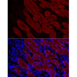 Aromatic-L-Amino-Acid Decarboxylase (DDC) Antibody