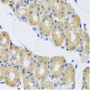 Immunohistochemistry of paraffin-embedded Human stomach using DYNC1I1 Antibody (1/100 dilution, 40x lens).