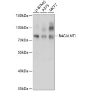 Western blot analysis of extracts of various cell lines using B4GALNT1 Antibody (1/3000 dilution).