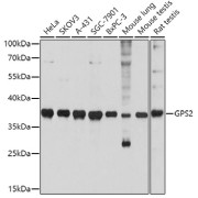 Western blot analysis of extracts of various cell lines using GPS2 Antibody (1/3000 dilution).