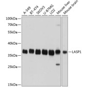 Western blot analysis of extracts of various cell lines using LASP1 Antibody (1/1000 dilution).