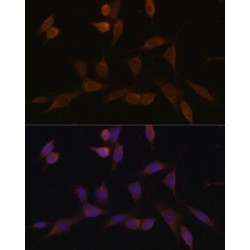 NADH Ubiquinone Oxidoreductase Subunit A5 (NDUFA5) Antibody