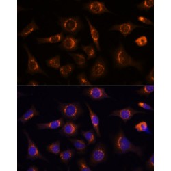 Nucleobindin-1 (NUCB1) Antibody