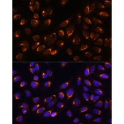 Nucleobindin-1 (NUCB1) Antibody