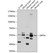 Western blot analysis of extracts of various cell lines using SRP54 Antibody (1/1000 dilution).