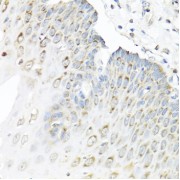 Immunohistochemistry of paraffin-embedded Human esophagus using STAU1 Antibody (1/100 dilution, 40x lens).