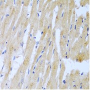 Immunohistochemistry of paraffin-embedded Rat heart using UBE2L3 Antibody (1/100 dilution, 40x lens).