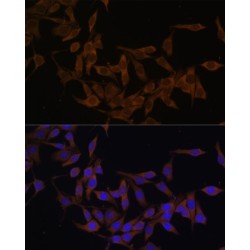 Ubiquitin-Conjugating Enzyme E2 L3 (UBE2L3) Antibody