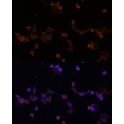 Ubiquitin-Conjugating Enzyme E2 L3 (UBE2L3) Antibody