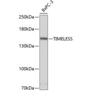 Western blot analysis of extracts of BxPC-3 cells using TIMELESS Antibody (1/3000 dilution).