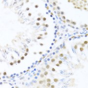 Immunohistochemistry of paraffin-embedded Rat testis using DDX46 Antibody (1/100 dilution, 40x lens).