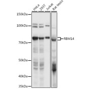 Western blot analysis of extracts of various cell lines using RBM14 Antibody (1/1000 dilution).