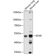 Western blot analysis of extracts of various cell lines using EDAR Antibody (1/1000 dilution).