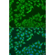 Immunofluorescence analysis of U2OS cells using ADAP1 Antibody (1/100 dilution). Blue: DAPI for nuclear staining.