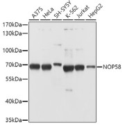 Western blot analysis of extracts of various cell lines using NOP58 Antibody (1/1000 dilution).