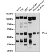 Western blot analysis of extracts of various cell lines using PELO Antibody (1/1000 dilution).