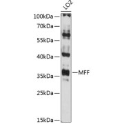 Western blot analysis of extracts of LO2 cells using MFF Antibody (1/3000 dilution).