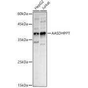 Western blot analysis of various lysates using AASDHPPT Antibody (1/1000 dilution).