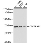 Western blot analysis of extracts of various cell lines using CDK5RAP3 Antibody (1/3000 dilution).