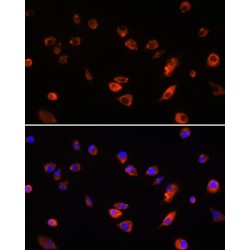 ADP-Ribosylation Factor-Like 13B (ARL13B) Antibody