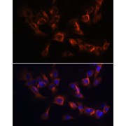 Immunofluorescence analysis of C6 cells using ARL13B Antibody (1/100 dilution). Blue: DAPI for nuclear staining.