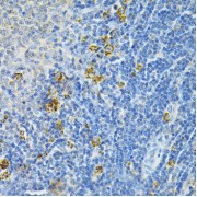 Immunohistochemistry of paraffin-embedded Rat spleen using GLRX Antibody (1/200 dilution, 40x lens).