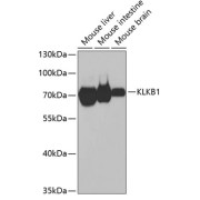 Western blot analysis of extracts of various cell lines using KLKB1 Antibody (1/1000 dilution).